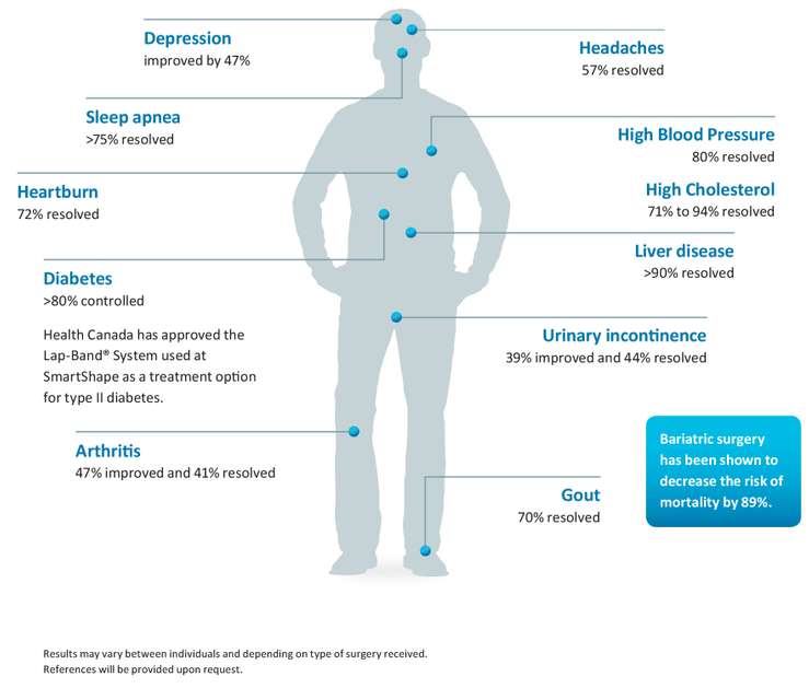 fe9669fa-swl-14-13-benefits-illustration-final_0kj0hh00000000000001o fe9669fa-swl-14-13-benefits-illustration-final_0kj0hh00000000000001o